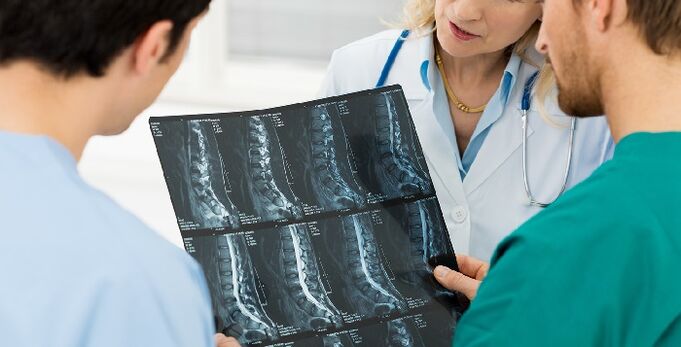 Röntgenfoto van de wervelkolom als een manier om osteochondrose te diagnosticeren