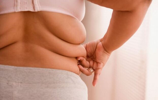 overgewicht, de oorzaak van cervicale osteochondrose bij vrouwen onder de 40