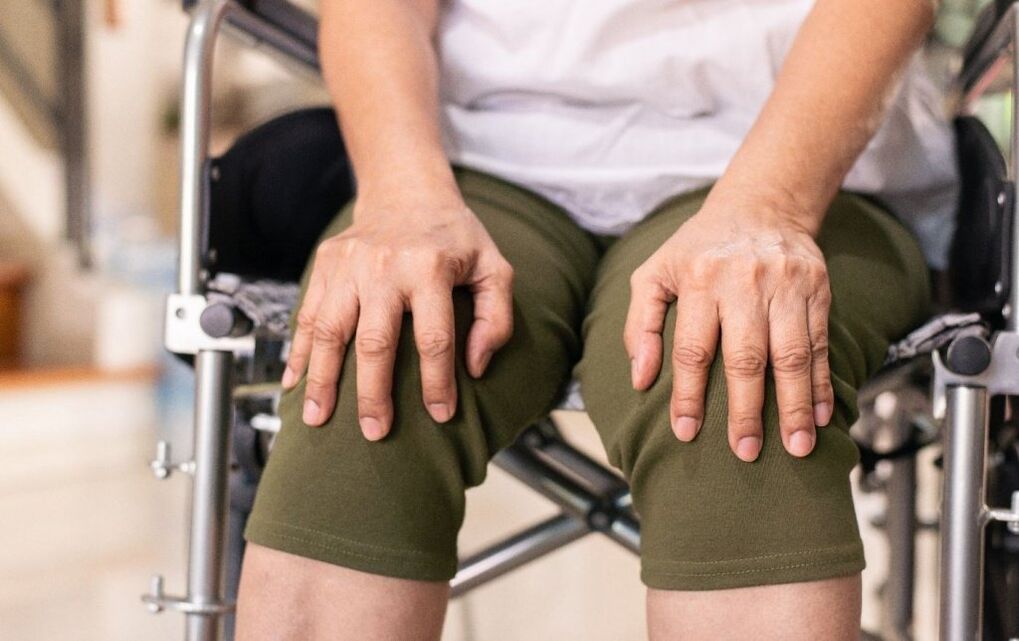 Een patiënt met artrose van de kniegewrichten
